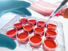 طرحی برای درمان سرطان به کمک سلول‌های خون بند ناف