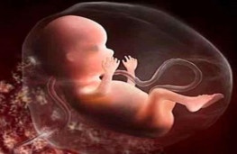 عضو هیات علمی پژوهشگاه ابن سینا : روزه‌داری در بارداری توصیه نمی‌شود